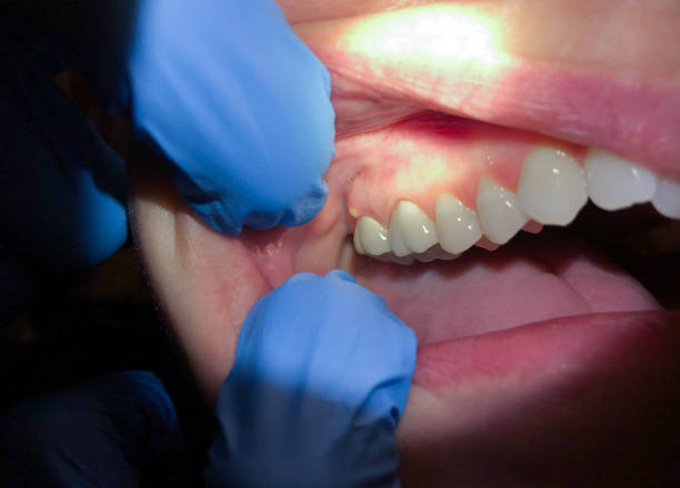 Best 24-Hour Emergency Dentist in Rantoul, IL