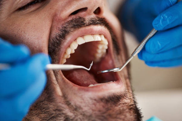 Best Emergency Treatment for Toothache in Rantoul, IL